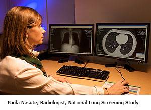 Paola Nasute, Radiologist, National Lung Screening Study
