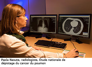 Paola Nasute, radiologiste, Étude nationale de dépistage du cancer du poumon